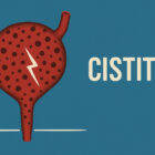 Cistite